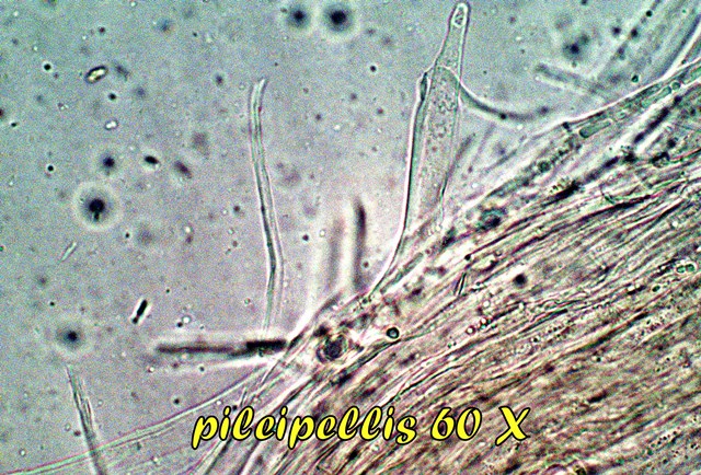 MICROSCOPIA ENTOLOMA REINWALDII